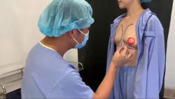 NGỰC SỪNG TRÂU CÓ HÌNH DÁNG RA SAO BÁC SĨ SẼ THỰC HIỆN NHƯ THẾ NÀO