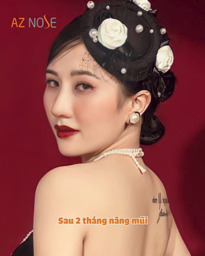 Nàng 9X nâng mũi xinh để lung linh trong ngày cưới