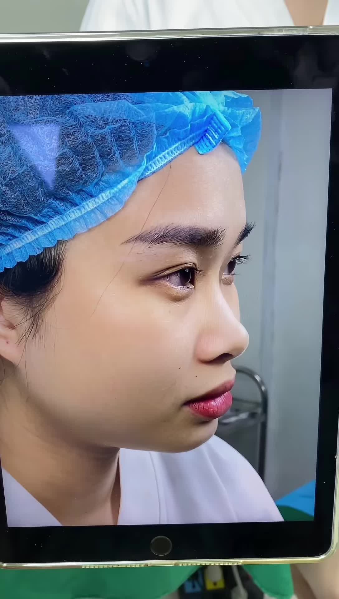 Bất ngờ với nhan sắc thay đổi ngoạn mục của Tiktoker Phan Ánh Ngọc