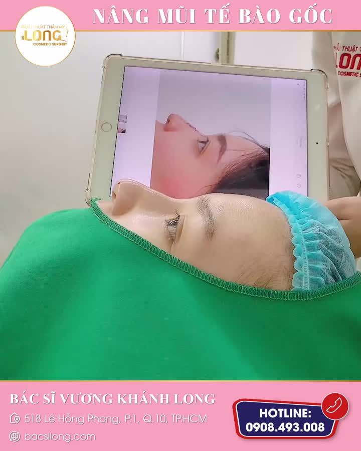MŨI CAO XINH…KHÔNG CẦN PHẪU THUẬT, TIN ĐƯỢC KHÔNG