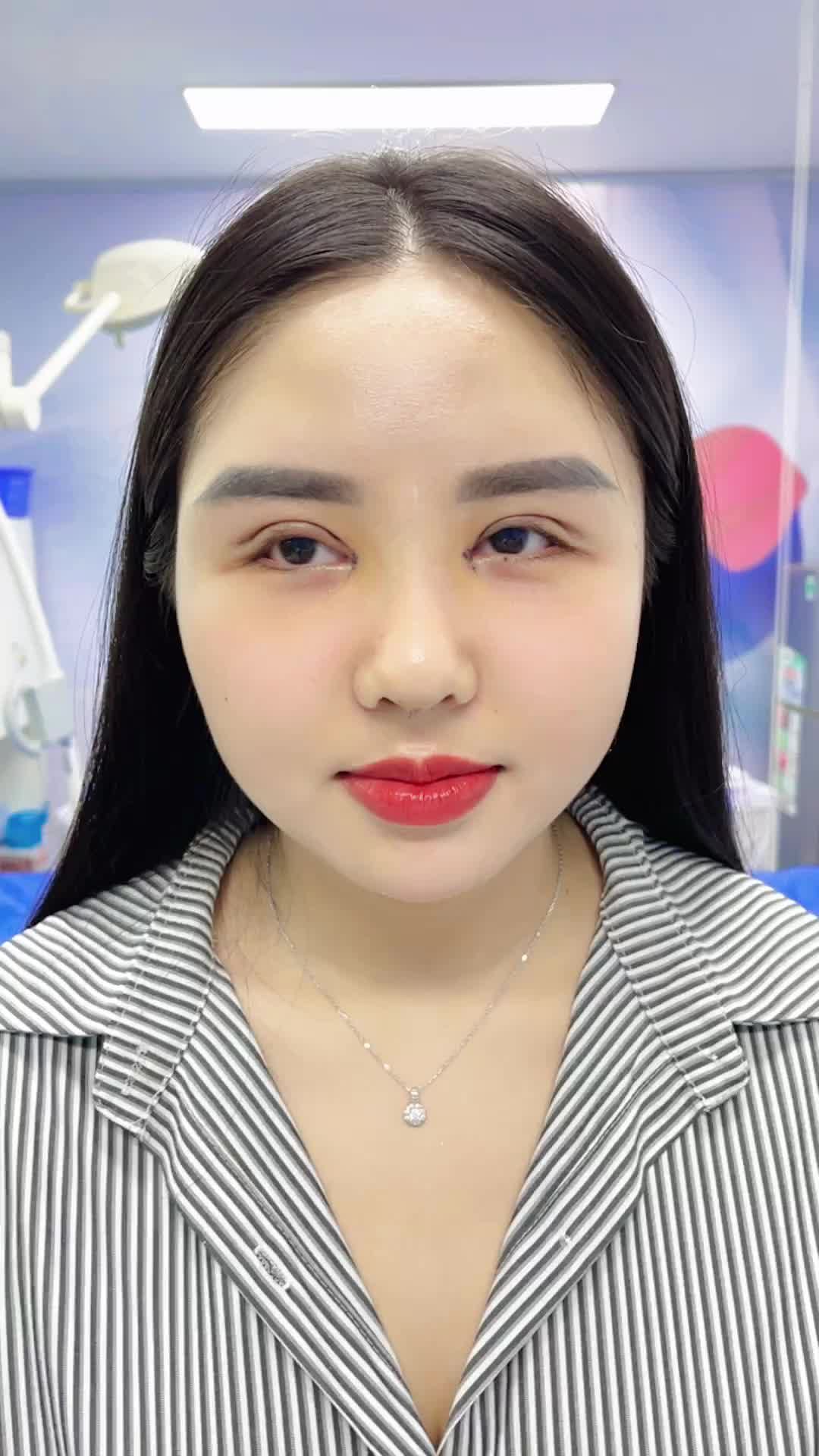 1 giấc ngủ trưa Tỉnh dậy có ngay Mũi + Mí đẹp ưng ý