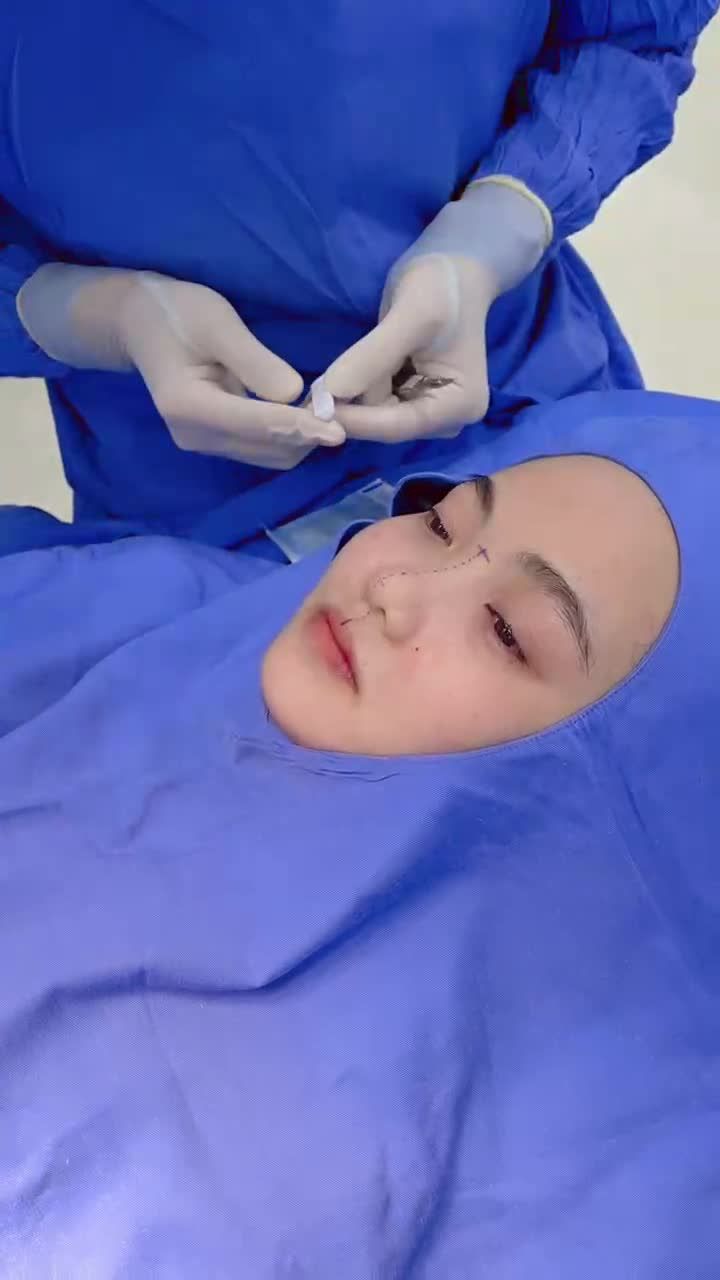 Bác sĩ Kangnam phân tích nâng mũi cho cô gái 23 tuổi