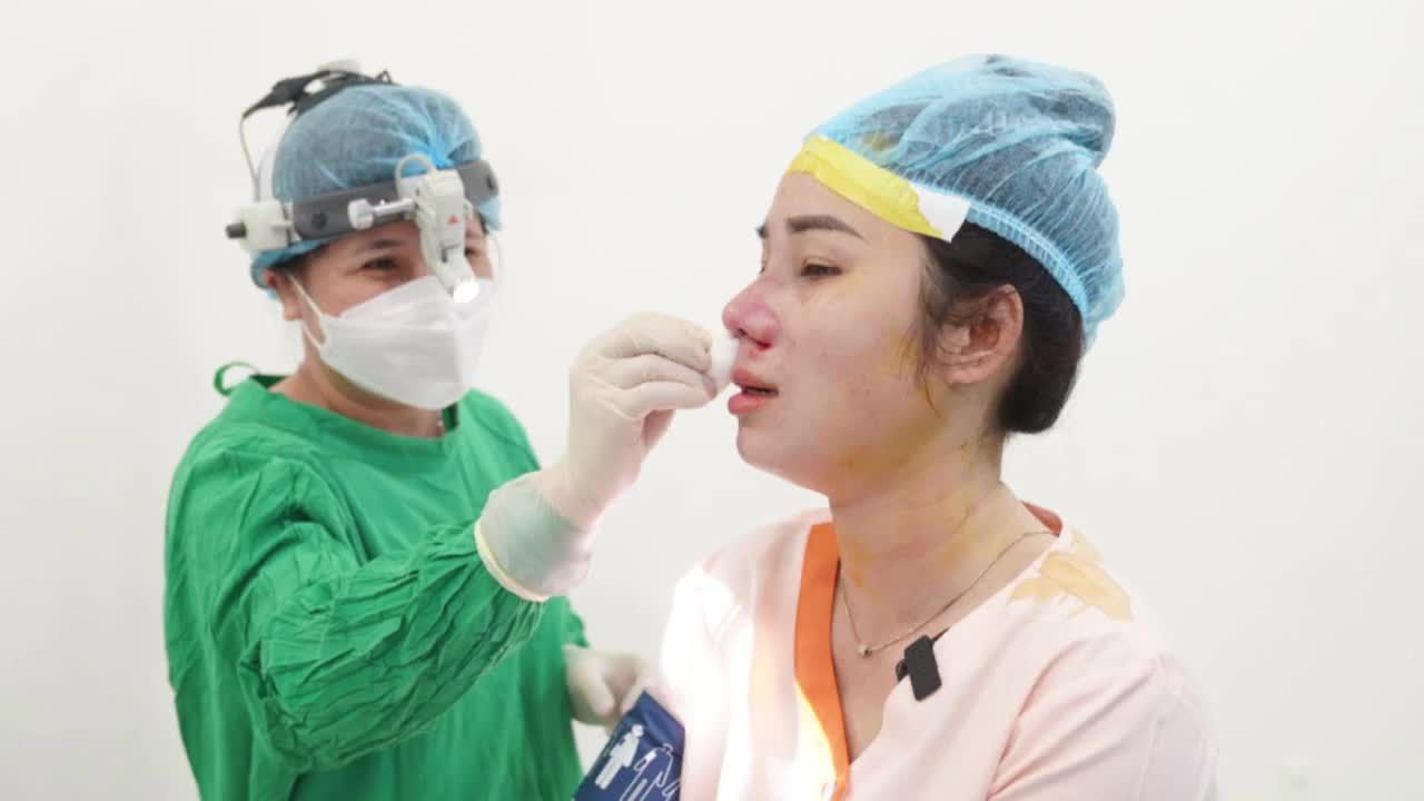 Khắc phục mũi th.ấp và ng.ắ.n cho khách hàng Đồng Nai