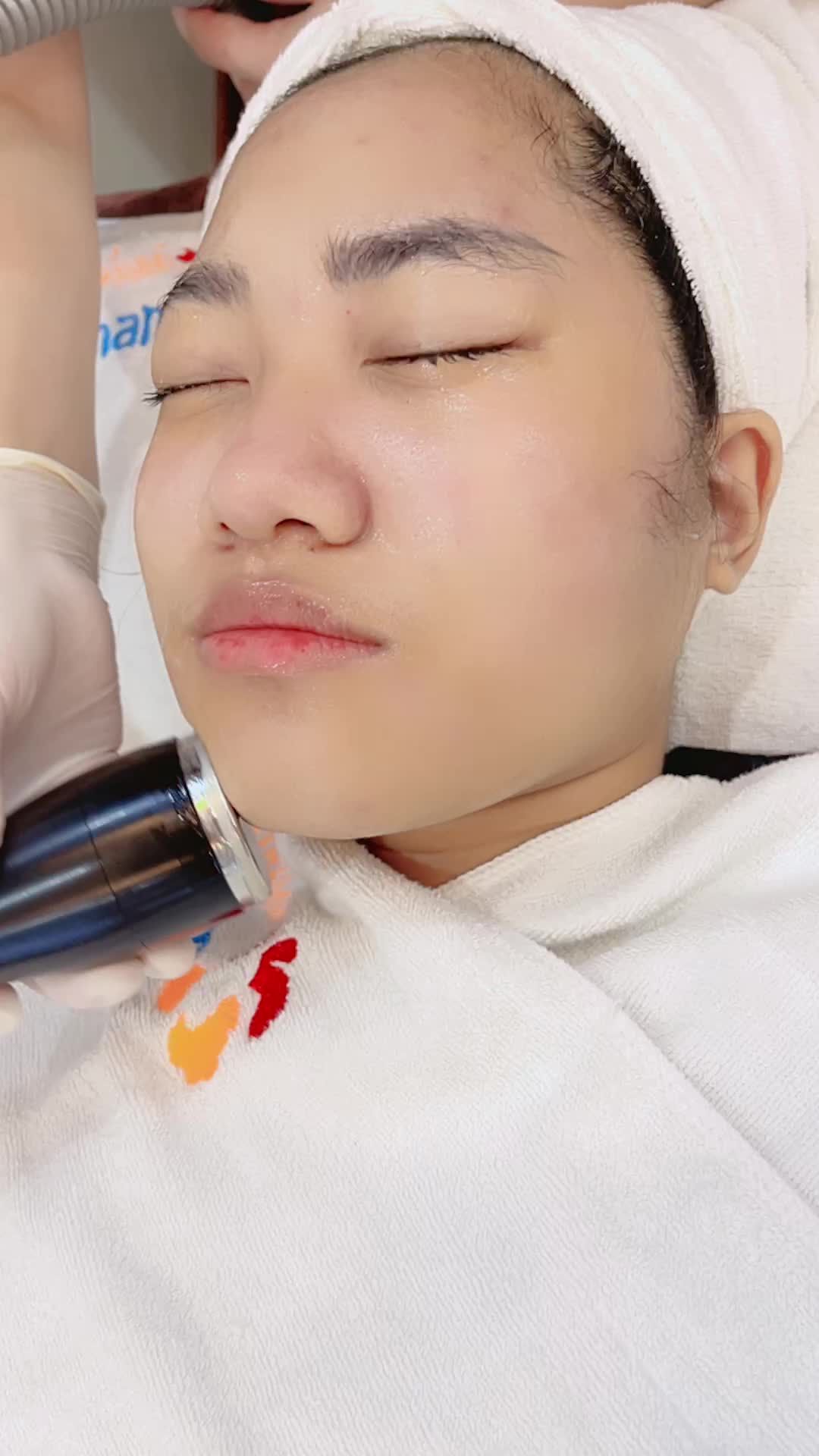 Trẻ hoá - Phục hồi da sau mụn chuẩn Hàn Quốc của tại Kangnam