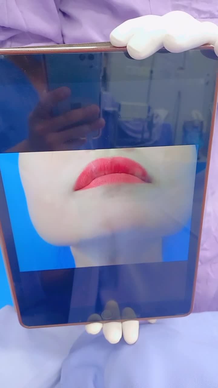 Cận cảnh xương hàm siêu to khổng lồ! Khi đi hàm bạnh, khi về V-Line là đây!!