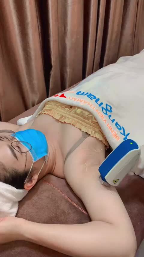 Quy trình triệt lông nách công nghệ Diode laser của khách hàng nữ lần thứ 2.