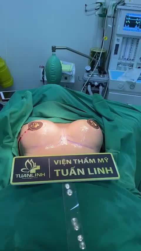 Nâng V1 nội soi được thực hiện tại Bệnh viện - Và kết quả sau 60 phút