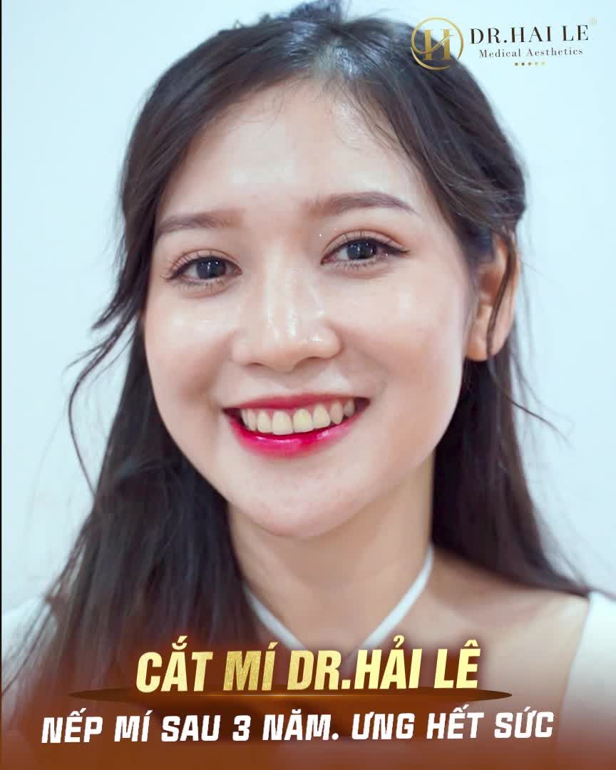 GÓC KHOE MÍ ĐẸP - DR.HẢI LÊ SÀI GÒN