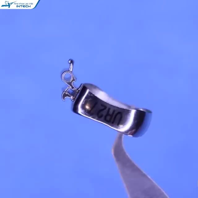 Band răng (hay còn gọi là khâu chỉnh nha) là một khí cụ được sử dụng trong quá trình chỉnh nha.