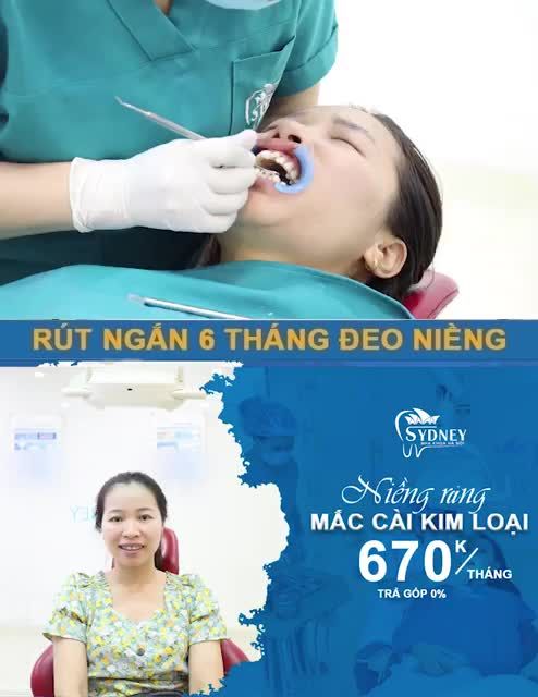 Bảo tồn răng thật, sở hữu hàm răng chắc khỏe nụ cười đẹp tự nhiên sau niềng răng.