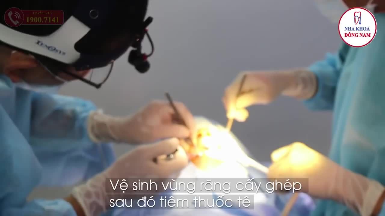 BS TRƯỞNG KHOA TRỰC TIẾP CẤY IMPLANT CHO BỆNH NHÂN