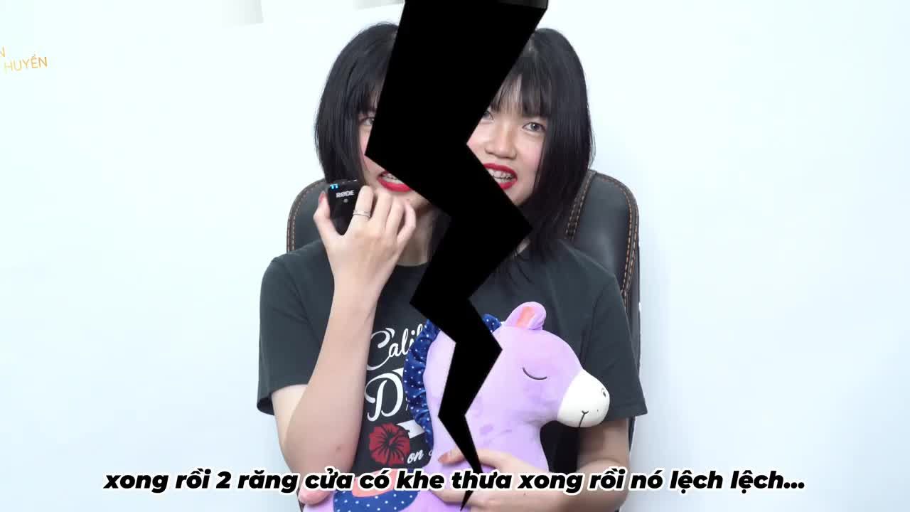 CHÚNG MÌNH ĐÃ LỰA CHỌN NIỀNG RĂNG KHÔNG NHỔ RĂNG