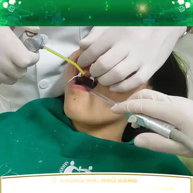 DÁN SỨ VENEER SIÊU MỎNG - BỀN ĐẸP - THOẢI MÁI ĂN NHAI