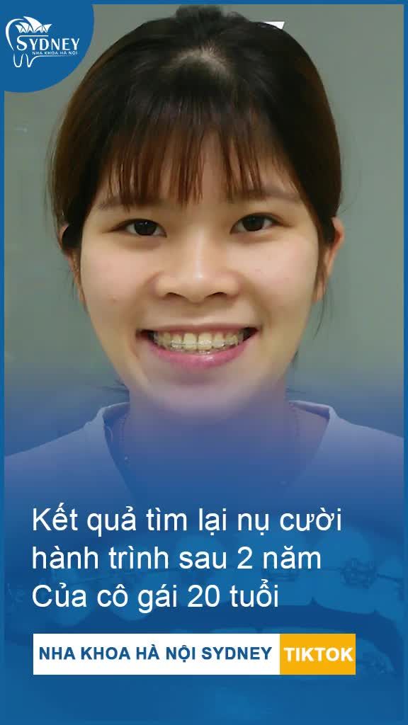 HÀNH TRÌNH TÌM LẠI NỤ CƯỜI