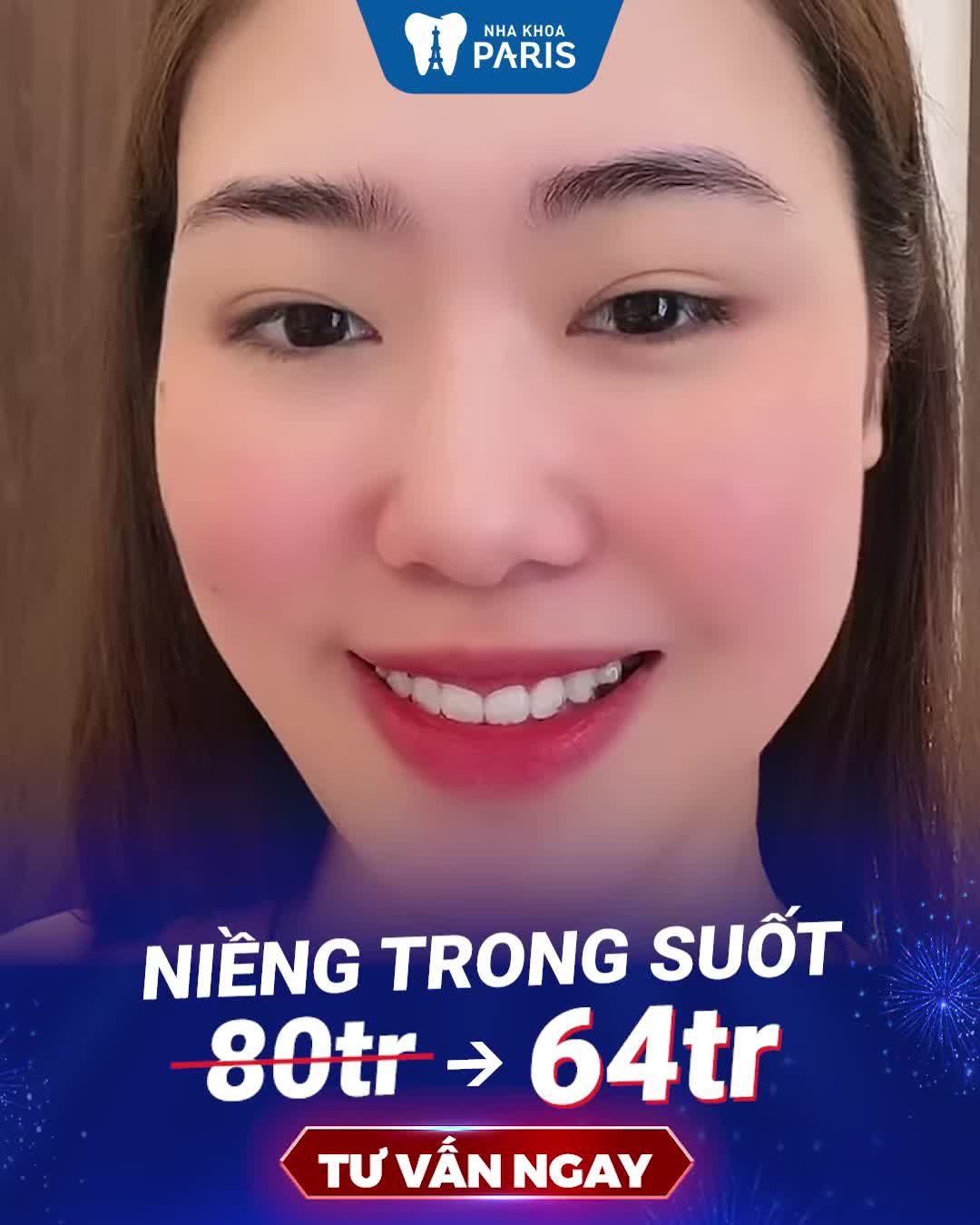 Hết Răng Hô  Thưa  Móm  Lệch Lạc