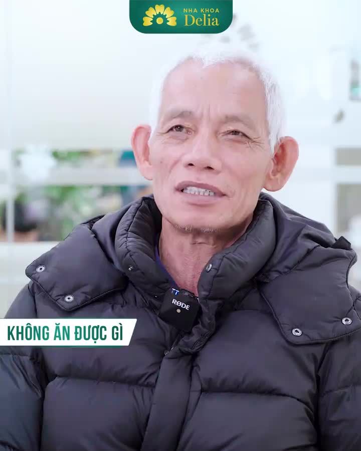KH. Nguyễn Văn Năm (56 tuổi) là một trường hợp điển hình mất nhiều răng, chú đã thực hiện cấy 9 trụ Implant tại Delia.