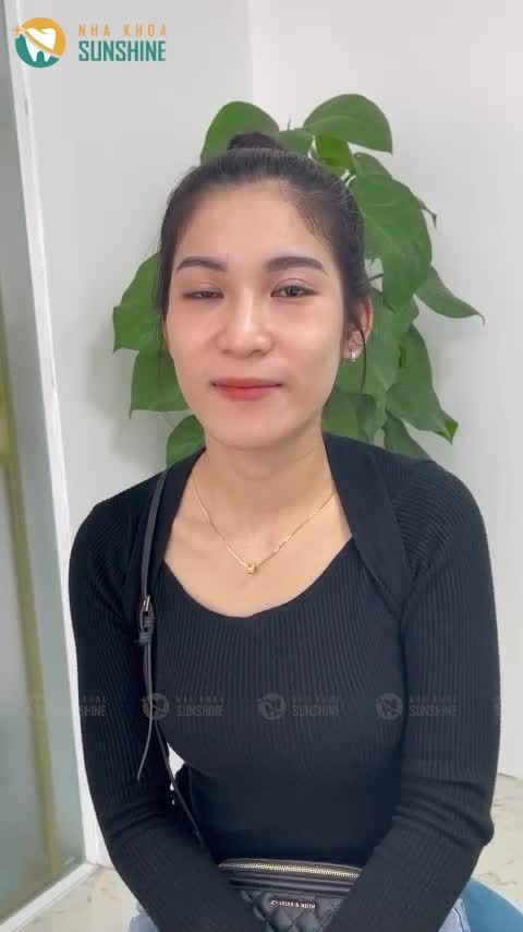 Làm răng sứ thẩm mỹ có thật sự khiến cả khuôn mặt, thần thái thay đổi