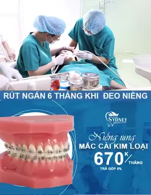 LÝ DO NÊN LỰA CHỌN NIỀNG RĂNG MẮC CÀI