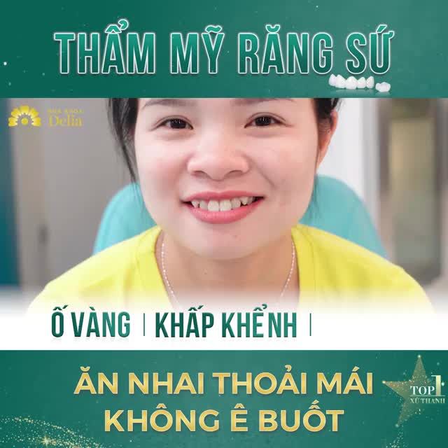 Ngay sau khi vừa được hoàn thiện răng sứ tại Delia Thanh Hóa
