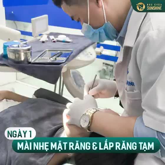 Nhiều người vẫn lần tưởng rằng bọc răng sứ thẩm mỹ sẽ phải rất mất nhiều thời gian, làm gián công việc, ảnh hưởng đến cuộc sống của họ.