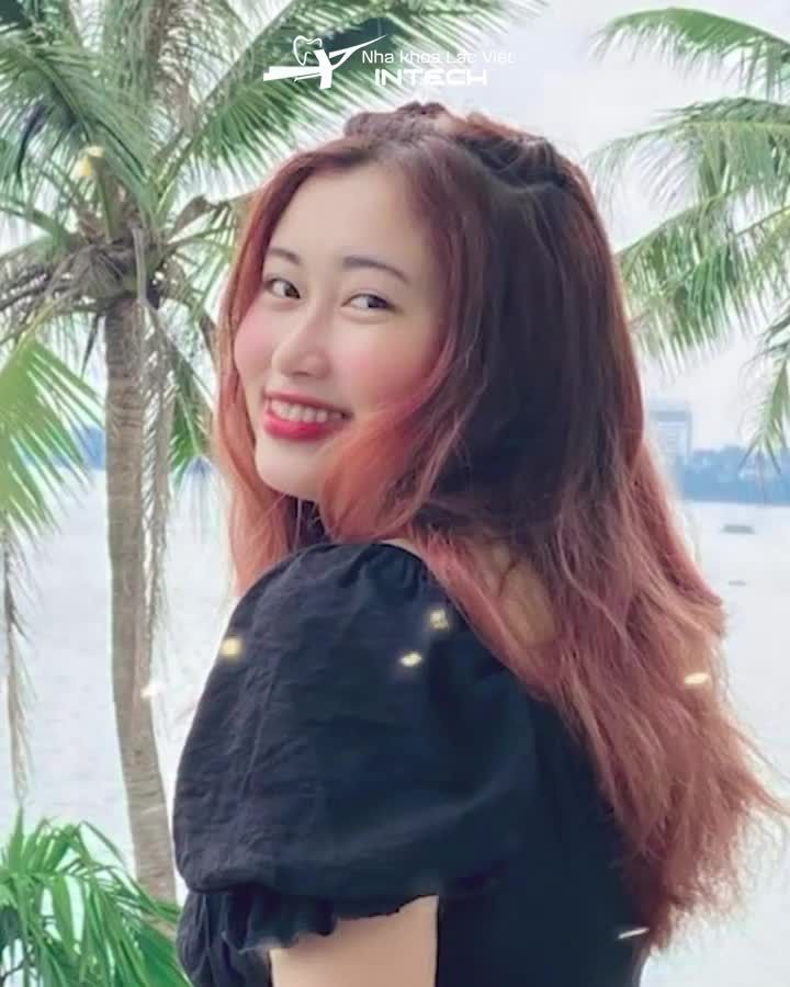 Niềng răng có thể thay đổi như thế nào