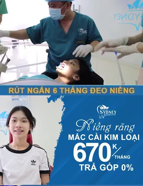 NIỀNG RĂNG HÔ CÓ THỰC SỰ HIỆU QUẢ