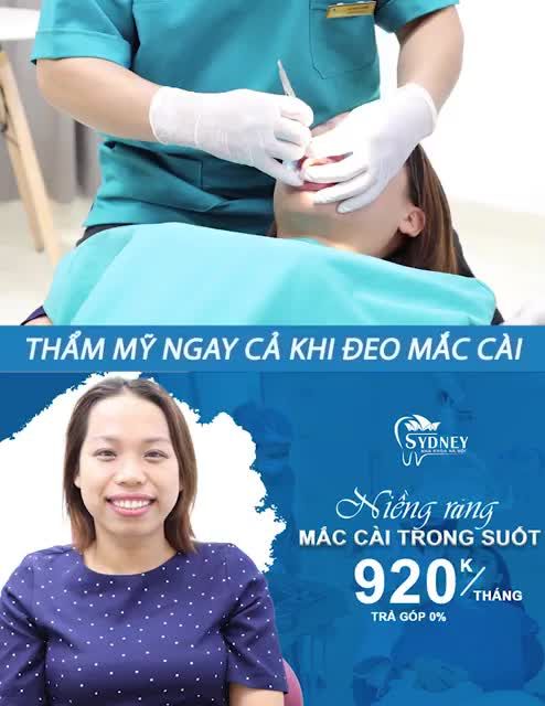 Niềng răng là cách chỉnh nha giúp bạn có hàm răng đều và đẹp hơn.
