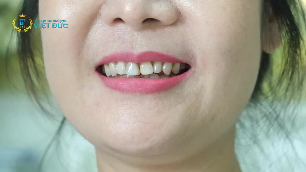 Nụ cười là đường cong quyến rũ nhất của người phụ nữ. Nụ cười đẹp chính là chìa khóa níu giữ thanh xuân.