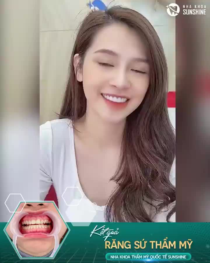 Phương pháp thẩm mỹ không dao kéo, chỉ sau 48H sở hữu nụ cười như ý.