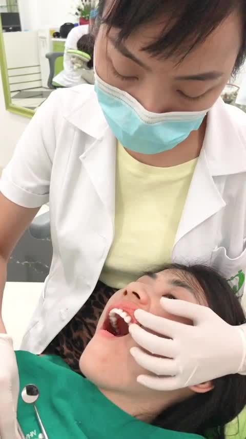 QUÁ TRÌNH LẮP RĂNG SỨ CHO MỘT NỮ KHÁCH HÀNG TẠI NHA KHOA GIA ĐÌNH
