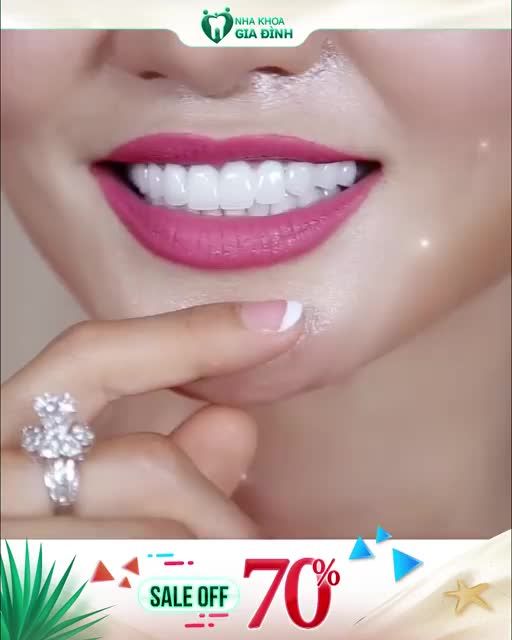 RĂNG TRẮNG BỀN ĐẸP - TỰ TIN ĐẾN TRỌN ĐỜI