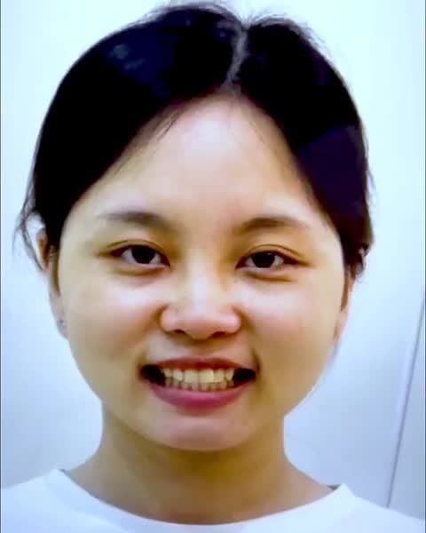 THÁO MẮC CÀI TẠM BIỆT RĂNG CHEN CHÚC, KHẤP KHỂNH