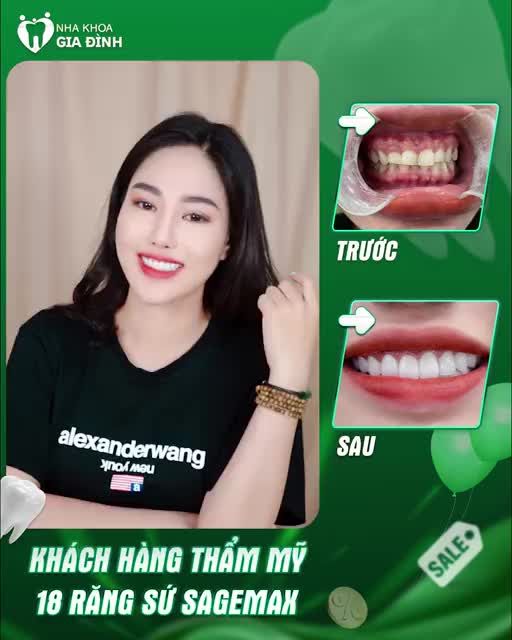 THAY ĐỔI NỤ CƯỜI – SÁNG BỪNG NHAN SẮC