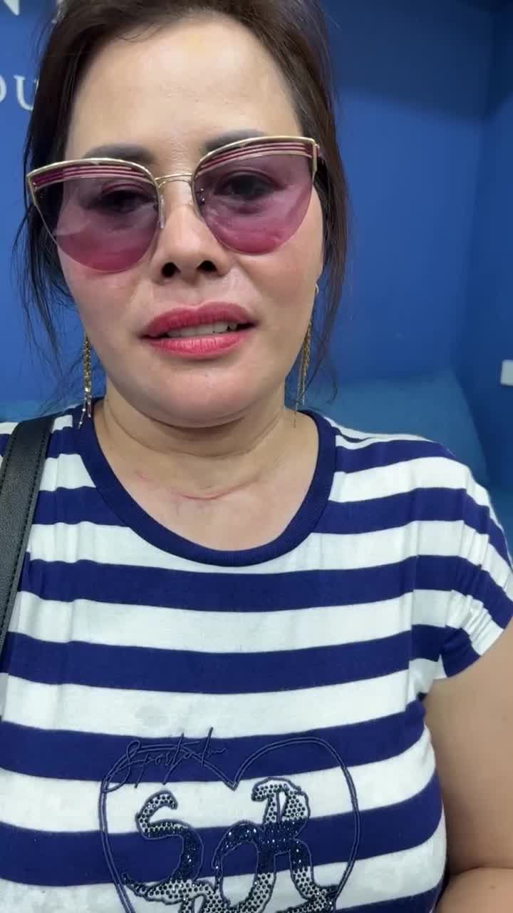 TRÒ CHUYỆN CÙNG CHỊ NGUYỆT - VIỆT KIỀU CỘNG HÒA SÉC (TIỆP KHẮC CŨ) SAU 4 NĂM LÀM RĂNG SỨ THẨM MỸ TẠI SHINBI!