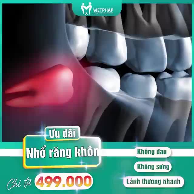 ƯU ĐÃI NHỔ RĂNG KHÔN TẠI VIỆT PHÁP