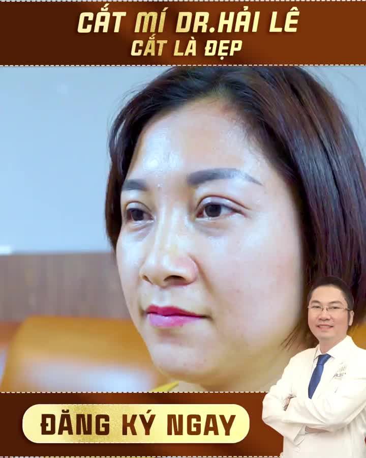 CẮT MÍ DR.HẢI LÊ - MẮT ĐẸP MÍ XINH - CÀNG NGẮM CÀNG MÊ