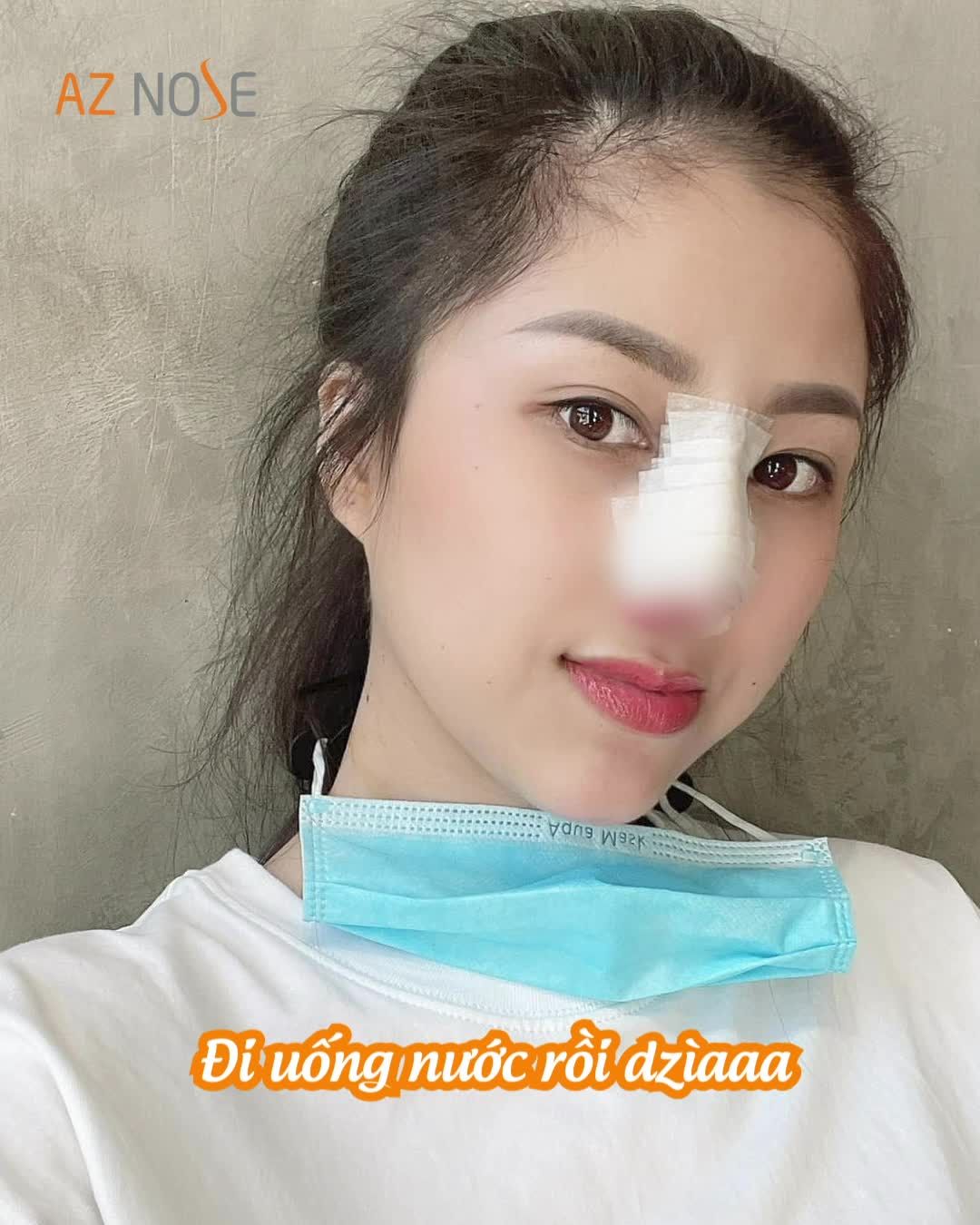 Vượt 250km đến Sài Gòn nâng mũi và cái kết hơn cả mong đợi