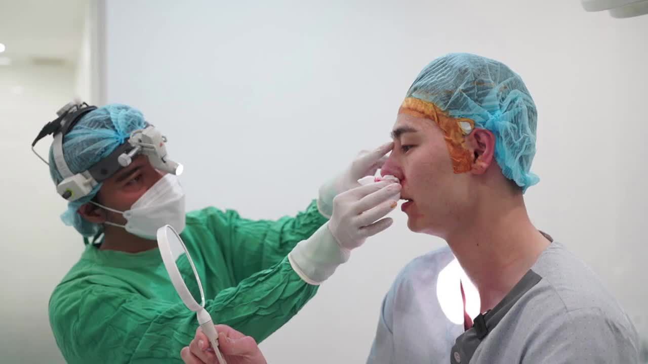 Ca nâng mũi cấu trúc sụn tai