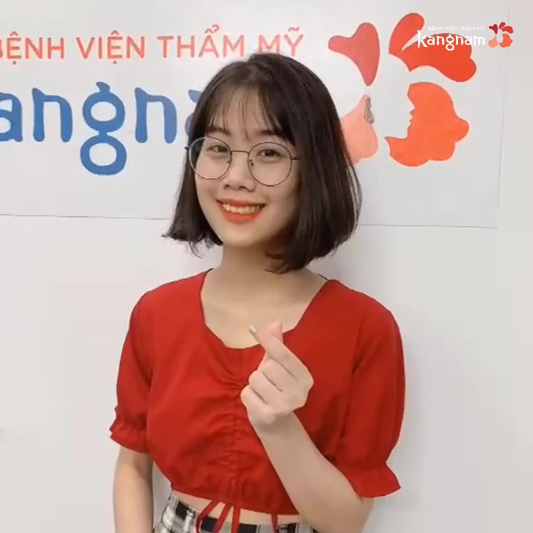 Khắc phục hoàn hảo Khớp cắn ngược - Mặt lưỡi cày