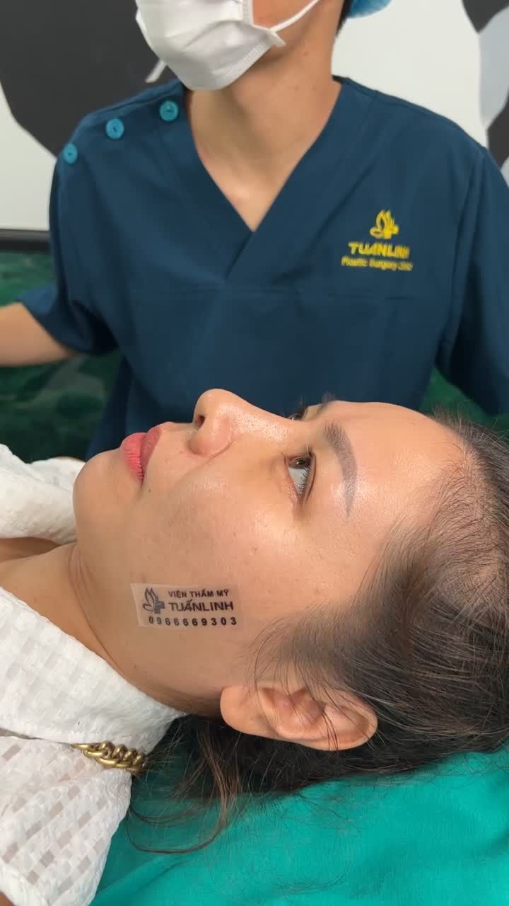 KẾT QUẢ SAU 10 NGÀY NÂNG SIÊU CẤU TRÚC + ĐỘN RÃNH CƯỜI