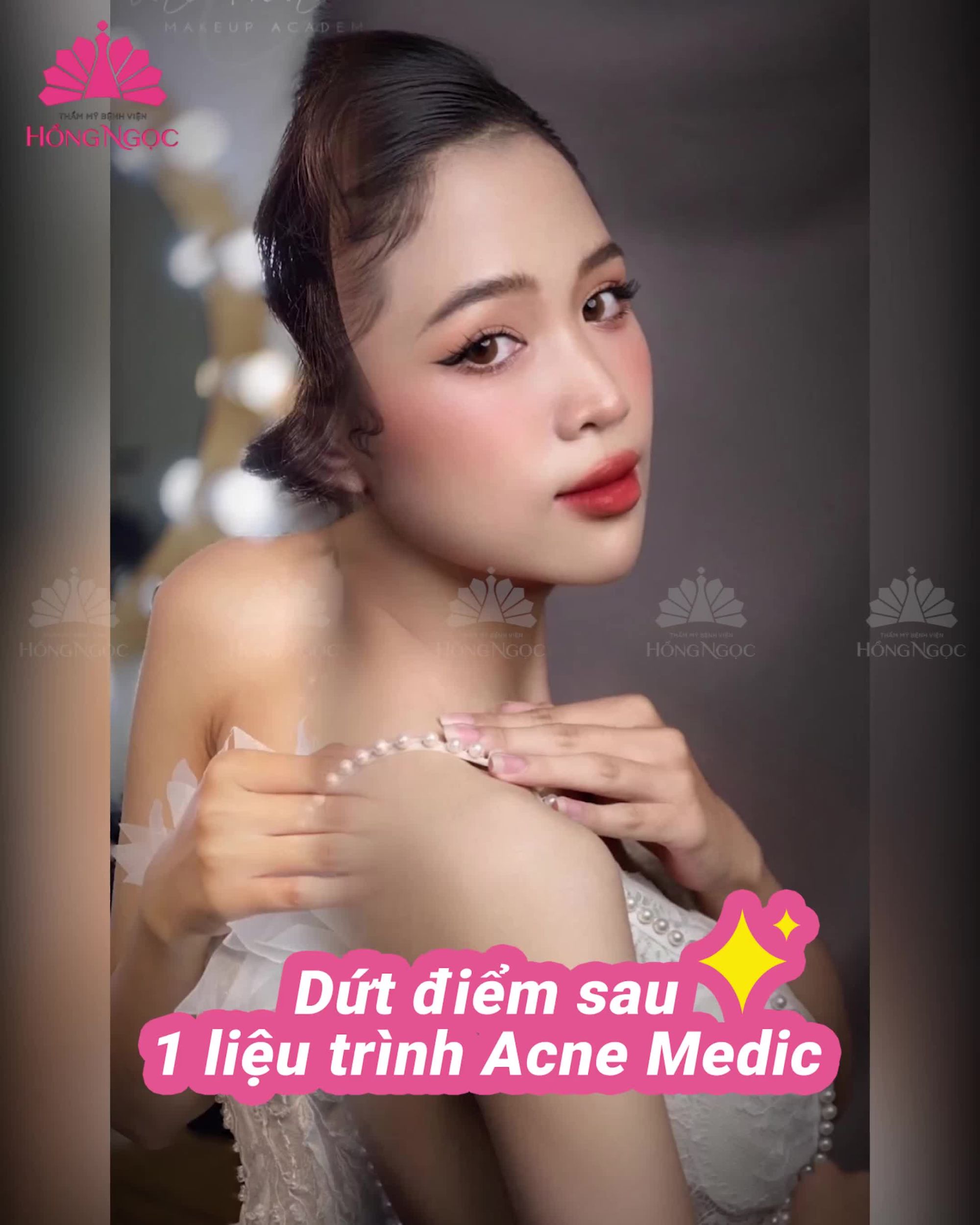 DA ĐẸP - MẶT XINH DIỆN GÌ CŨNG LUNG LINH
