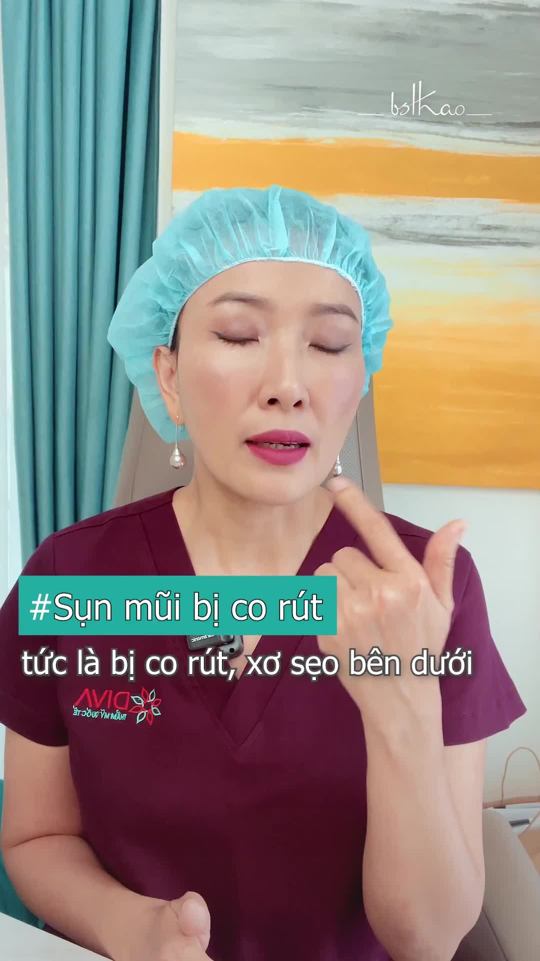 SAU THÁO SỤN MŨI CHÓP MŨI BỊ CO RÚT NÊN TIÊM MỠ HAY FILELR