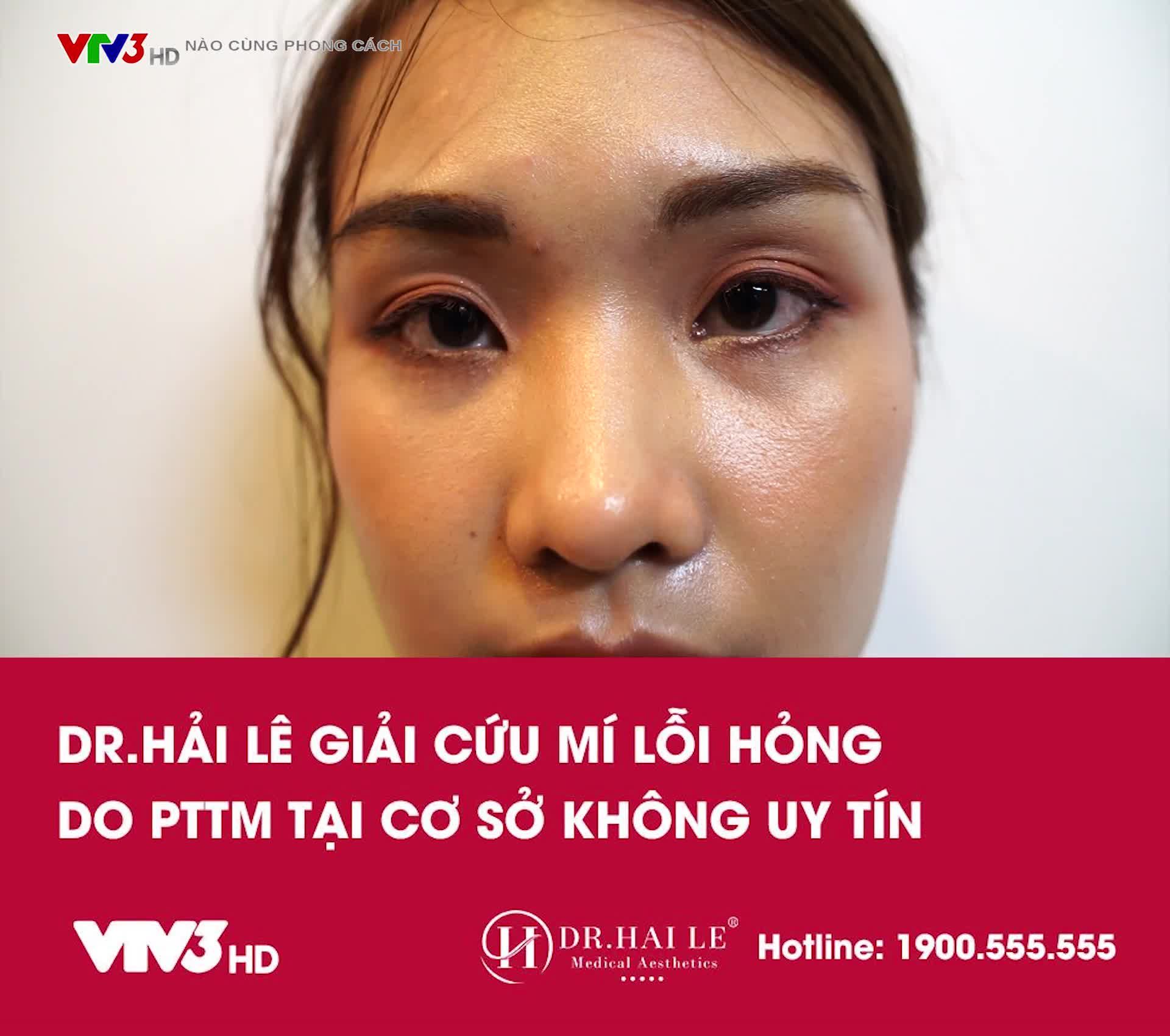 GIẢI CỨU MÍ HỎNG DEEP TECH20 TẠI DR.HẢI LÊ.