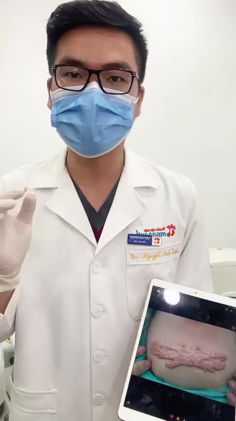 Trị sẹo lồi hiệu quả - Tiết kiệm chi phí