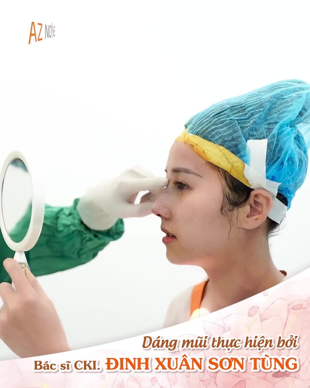 Khách hàng 9X xinh đẹp với dáng mũi mới