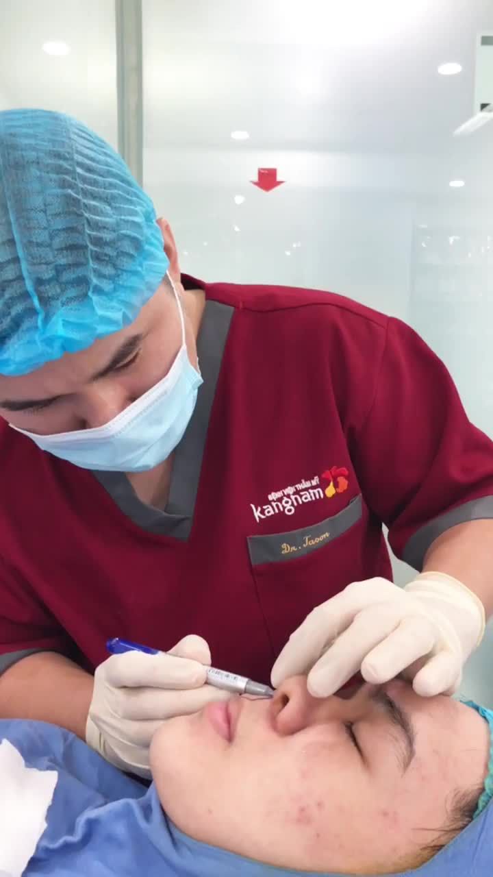 Phân tích quá trình thu nhỏ cánh mũi