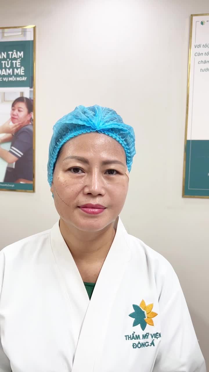 CẢM NHẬN CỦA CHỊ KHÁCH SAU KHI CĂNG CHỈ NỬA MẶT TẠI ĐÔNG Á