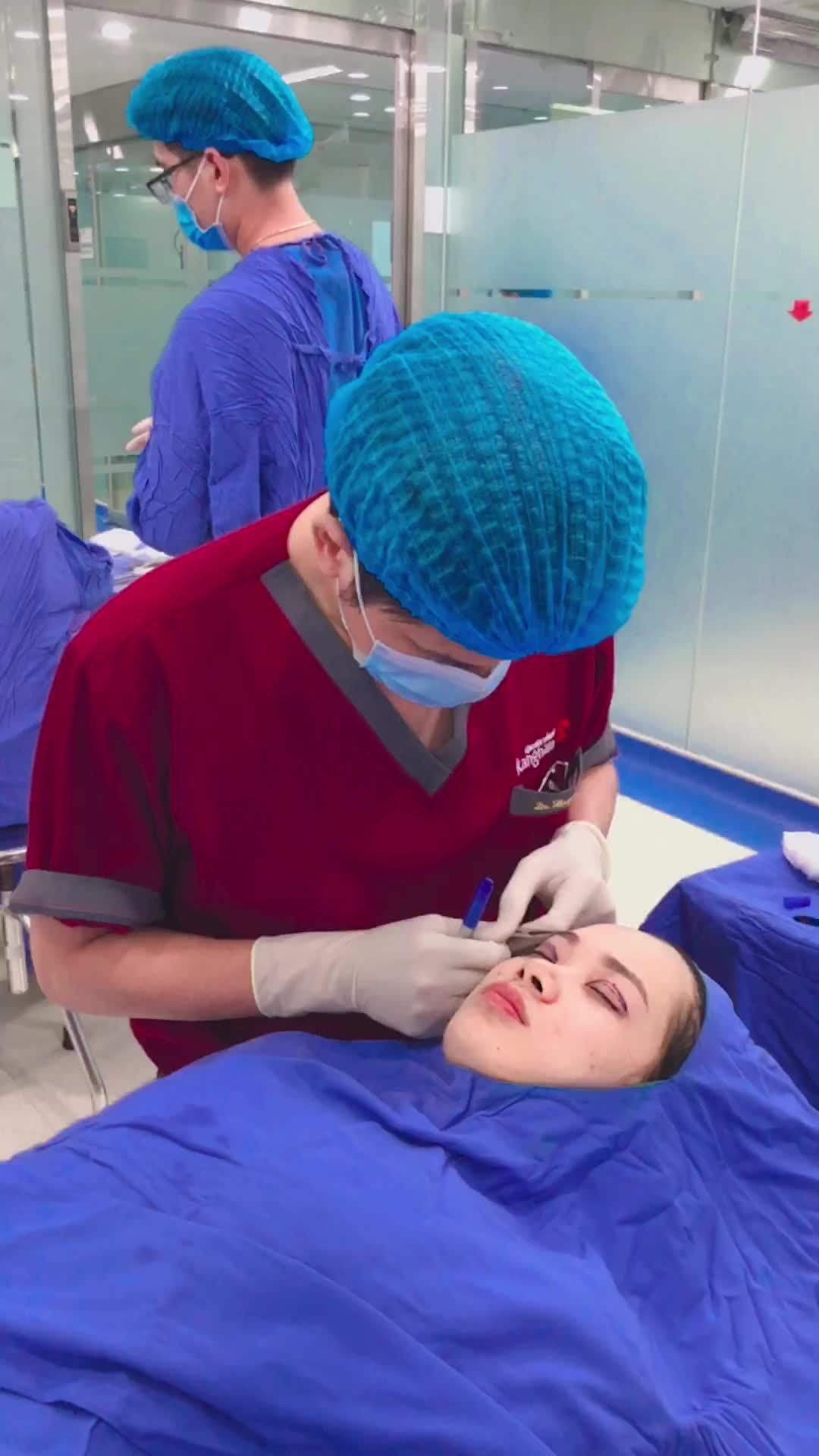 Đo vẽ cắt mí - Công đoạn quan trọng nhất trong quá trình thực hiện
