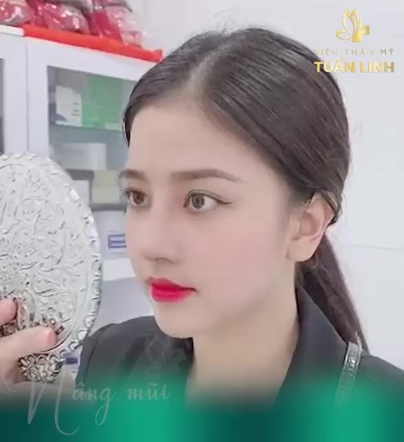 Nâng mũi chưa bao giờ dễ dàng như thế!!!