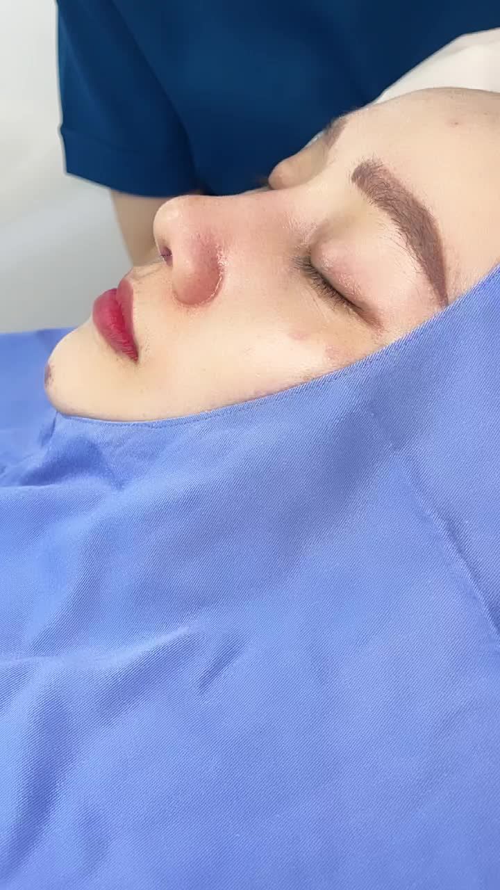 No makeup, no fillter!!! Ở đây chỉ có một chiếc mũi với dịch vụ Nâng mũi 6D Không đau siêu đẹp và tự nhiên